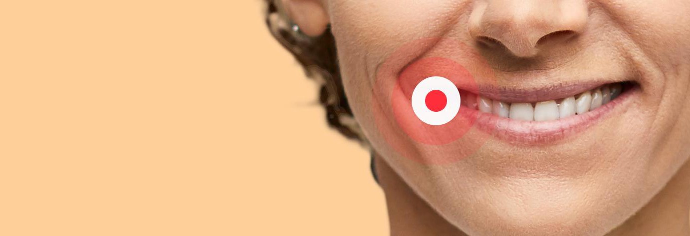 image of a smiling woman with a red circle indicating a cold sore