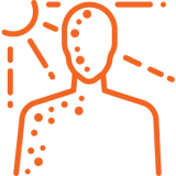 heat rash caused by sun exposure