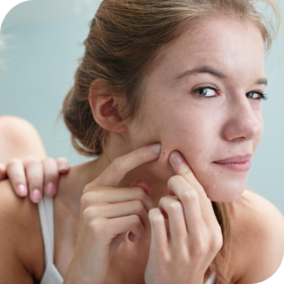 young woman popping a pimple on face